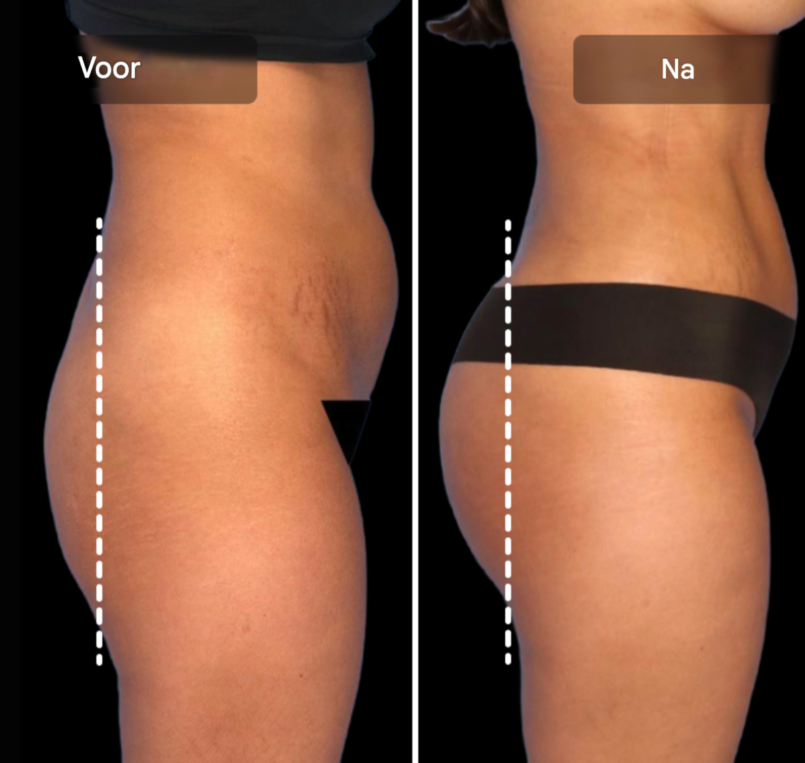 Wave EMS Toning Shorts